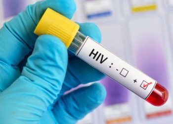 Studimi befasues në Kongo/ Shpresë për zbulimin e ilaçit kundër HIV-AIDS