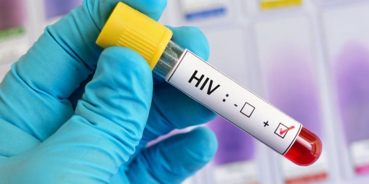 Studimi befasues në Kongo/ Shpresë për zbulimin e ilaçit kundër HIV-AIDS