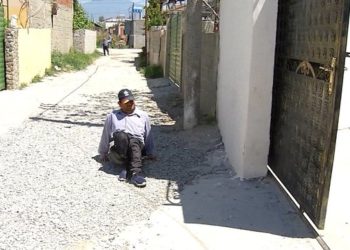 As ecën dhe as flet, 45-vjeçari pa gjymtyrë mes vështirësive për të lëvizur, nëna lutet për një karrocë (Historia e trishtë)