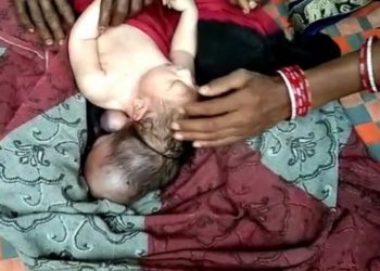 Lind foshnja me tre koka, pelegrinazhe pa fund në Indi (foto)