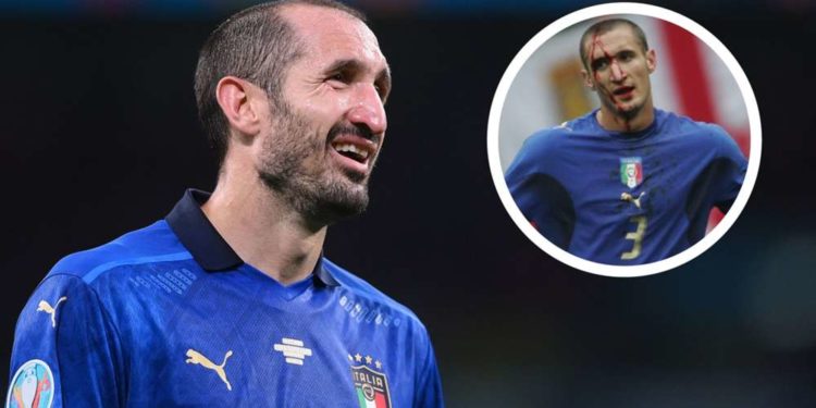Chiellini është gati të derdhë gjak përsëri në “Wembley”