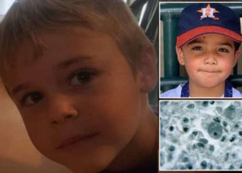 7-vjeçari ndërron jetë nga një parazit i rrallë