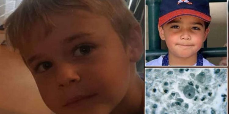 7-vjeçari ndërron jetë nga një parazit i rrallë