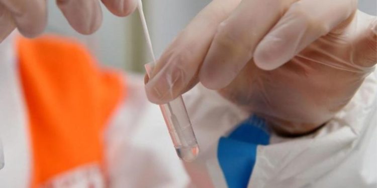 Studimi: Prekja nga Covid është shumë herë më e dëmshme se sa efektet anësore të vaksinës