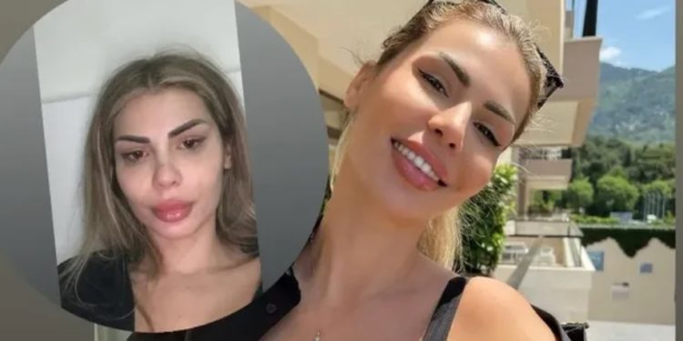 Luana Vjollca mes lotësh: Jeta e vërtetë nuk është si ajo që shihni në Instagram