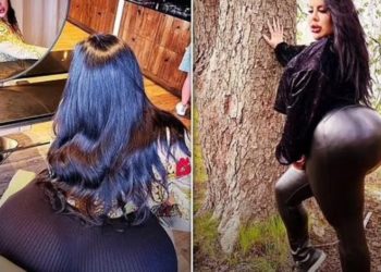 Ka bërë 5 operacione për ngritjen e vitheve, 29 -vjeçarja nuk mund të ulet në karrige