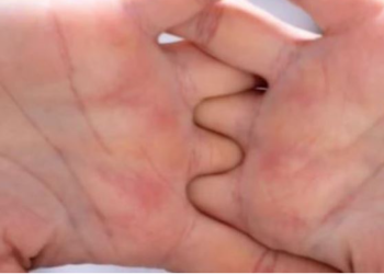 Hiqni dorë menjëherë nga ky zakon që bëni me duart