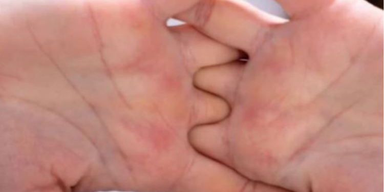 Hiqni dorë menjëherë nga ky zakon që bëni me duart