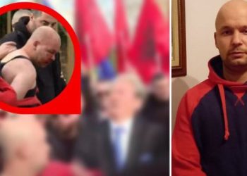 Goditi Berishën me grusht, zbulohet çrregullimi nga i cili vuan i riu