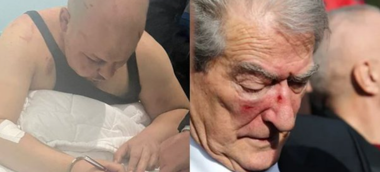 Grushti për Berishën, 31-vjeçari nuk pranon të japë dëshmi