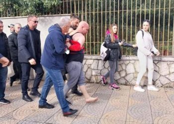 Dëmtime në kokë dhe në fytyrë, ja gjendja shëndetësore të riut që goditi Berishën