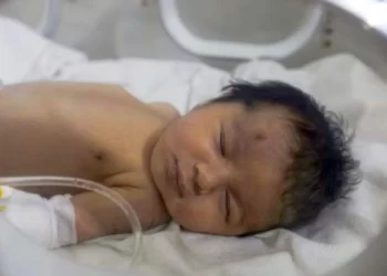 Lindi nën rrënojat e tërmetit, mijëra njerëz ofrohen të adoptojnë Ayan