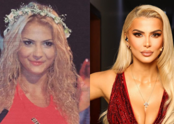 Marina Vjollca mohon operacionet plastike: E vetmja ndërhyrje janë dhëmbët! (FOTO)