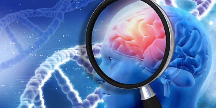 Gjashtë shenjat fillestare të sklerozës, ja si t’i dalloni