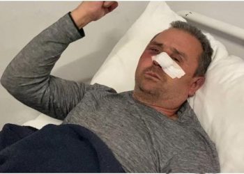 “Më goditën me tytën e automatikut, iu thosha s’kam lekë”, 54-vjeçari tregon tmerrin me hajdutët që iu futën në shtëpi