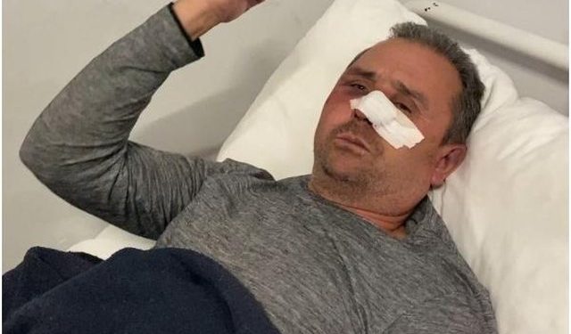 “Më goditën me tytën e automatikut, iu thosha s’kam lekë”, 54-vjeçari tregon tmerrin me hajdutët që iu futën në shtëpi