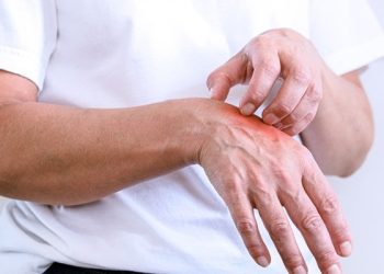 Shpjegimi/ Pse janë shtuar rastet me zgjebe në Shqipëri