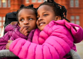 Mjekët i dhanë pak ditë jetë, binjaket e ngjitura që i treguan botës se e kanë gabim: Si është të jetosh në një trup