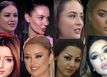 Para dhe pas operacionit, si janë transformuar disa nga vipat shqiptarë (FOTO)