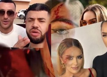 Vipat dhe Vipeshat e Shqipërisë!