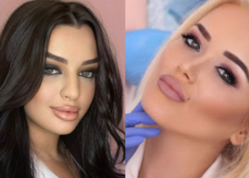 Kush janë admistratoret që kontrabandonin “BOTOX” për klinikat e tyre në Tiranë!