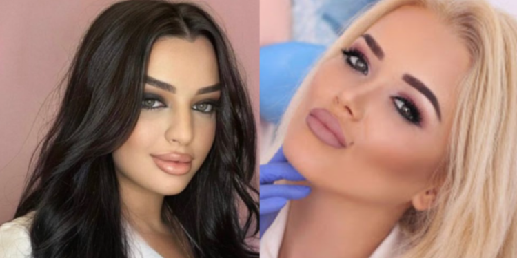 Kush janë admistratoret që kontrabandonin “BOTOX” për klinikat e tyre në Tiranë!