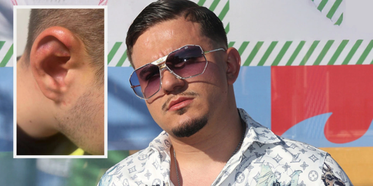 Rrëmbehet dhe torturohet në Athinë djali i biznesmenit të njohur (FOTO)