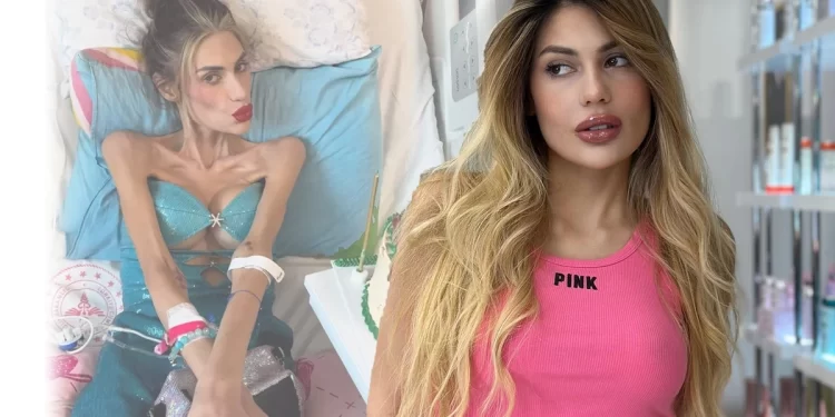 Kush ishte Nihal Candan? Gjithçka rreth influencueses turke që ndërroi jetë nga anoreksia