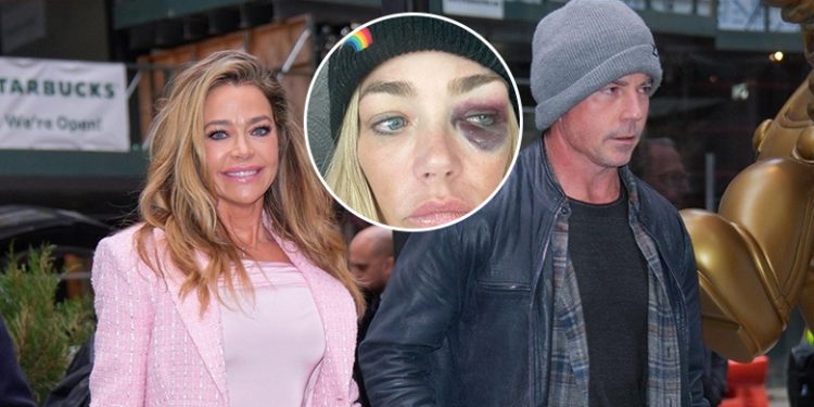 Denise Richards merr urdhër mbrojtjeje ndaj bashkëshortit: Më ka goditur dhe më ka zënë për fyti