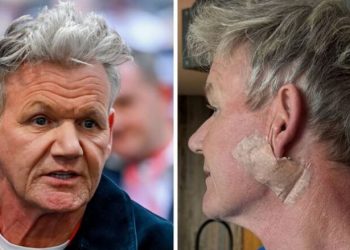Gordon Ramsay kalon nëpër një operacion për kancerin e lëkurës: Mesazhi i tij për fansat
