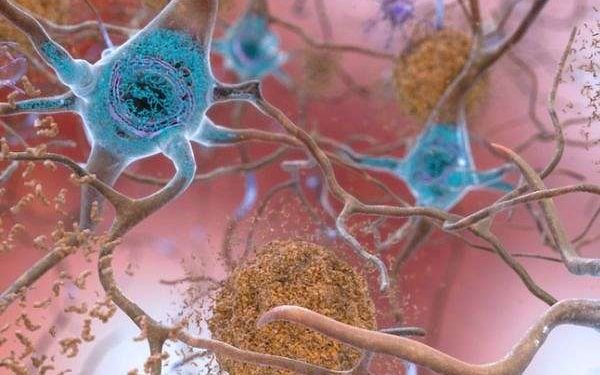 Studimi i Harvardit arrin të zhdukë simptomat e Alzheimerit për herë të parë tek minjtë – Balkanweb.com – News24