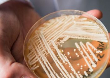 Një kërpudhë vrasëse alarmon spitalet/ Ja vendi më i prekur