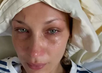 Bella Hadid shfaqet për herë të parë në publik pas zbulimit të betejës me Lyme disease