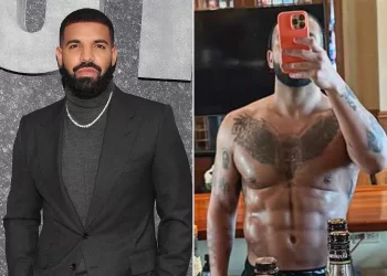 Ka bërë ndërhyrje plastike në trupin e tij? Flet për herë të parë Drake