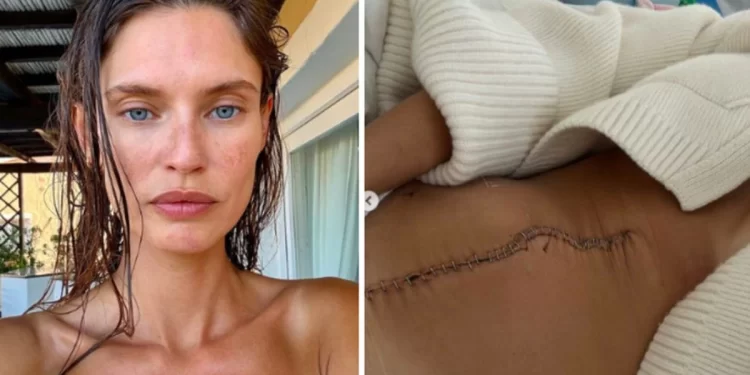 Victoria’s Secret e refuzoi sepse ka kancer: letra prekëse e Bianca Balti që tronditi botën e modës
