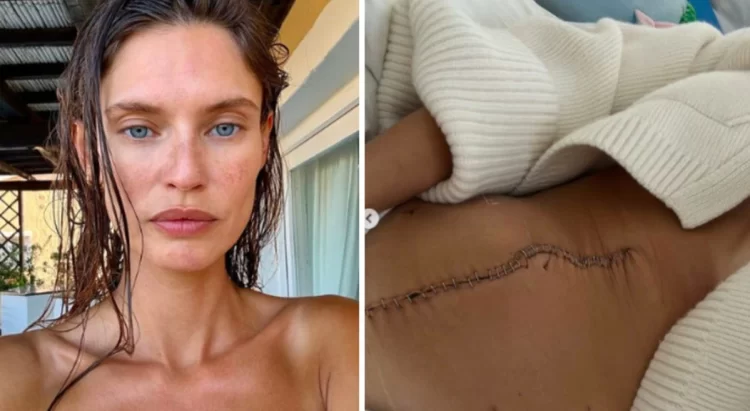 Victoria’s Secret e refuzoi sepse ka kancer: letra prekëse e Bianca Balti që tronditi botën e modës
