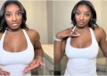 Simone Biles përshkruan momentin e panikut që ndjeu pas zmadhimit të gjoksit