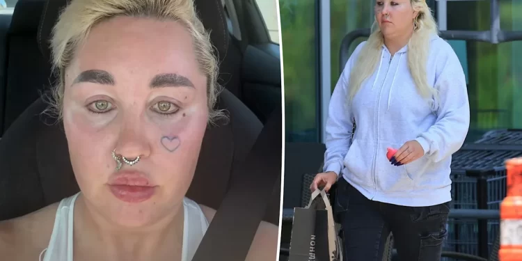 Amanda Bynes tregon transformimin e saj me Ozempic: Kam humbur nëntë kilogramë dhe dua të vazhdoj