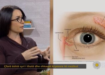 Okulistja tregon rrezikun e fshehur pas qerpikëve falsë