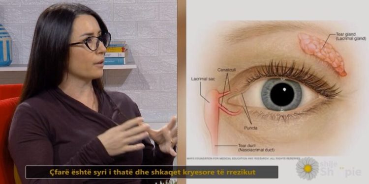 Okulistja tregon rrezikun e fshehur pas qerpikëve falsë