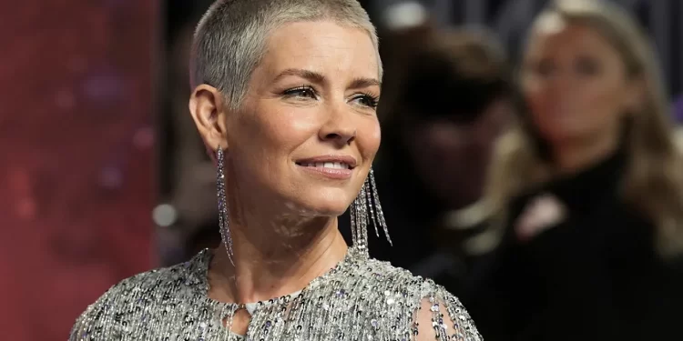 Ylli i Lost, Evangeline Lilly, flet hapur: Kam pësuar dëmtime në tru pas aksidentit