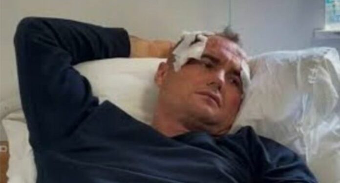 Çmenduri shqiptare/ Polici rreh babë e bir në pragun e derës për një kompliment në rrjetet sociale ndaj motrës së tij