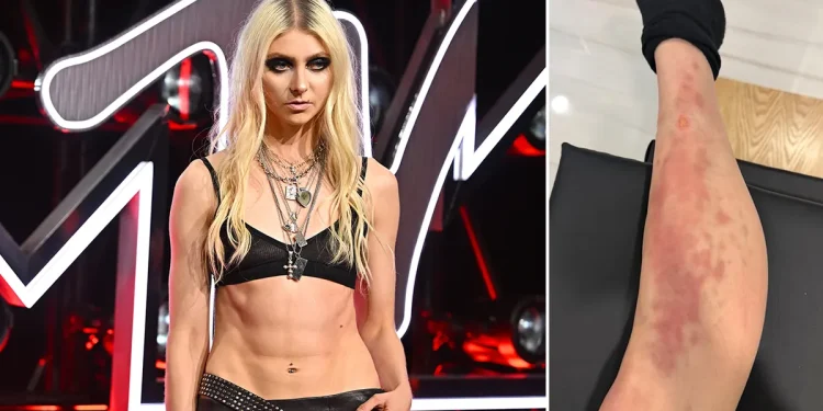 Këngëtarja e njohur amerikane përfundon në spital pas pickimit nga një merimangë helmuese në Meksikë