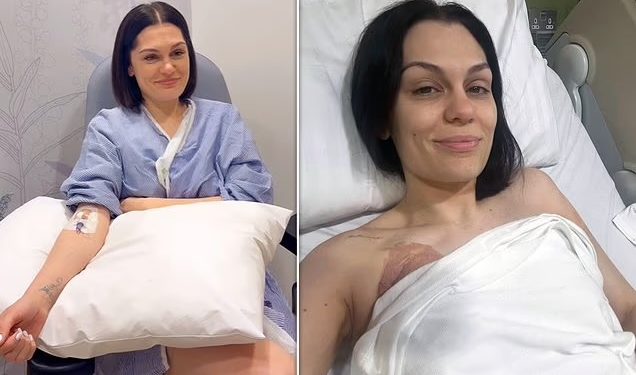 Jessie J zbulon se ka mposhtur kancerin: “Qava me orë të tëra”