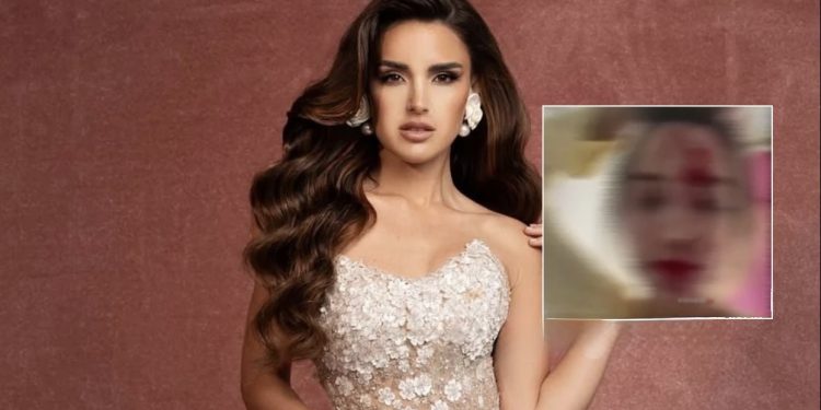 Miss Venezuela 2025 sulmohet në Kanë, stilisti i saj arrestohet nga policia