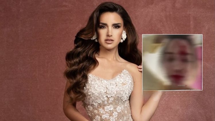 Miss Venezuela 2025 sulmohet në Kanë, stilisti i saj arrestohet nga policia