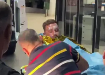 Identifikohen katër të plagosurit nga zjarri në skafin në Porto Palermo, një prej tyre me 50% të trupit të djegur