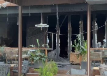 Zjarri në hotelin e Vlorës, Ministria e Shëndetësisë për të lënduarit: Një paciente në gjendje të rënduar nga djegiet