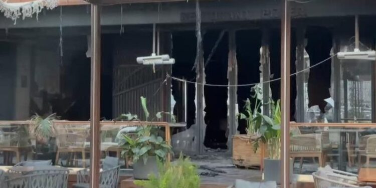 Zjarri në hotelin e Vlorës, Ministria e Shëndetësisë për të lënduarit: Një paciente në gjendje të rënduar nga djegiet