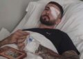 Flet i riu i plagosur në protestë: Më goditi plumbi i gomës në sy, bëra dy hapa dhe rashë në tokë. Kam shumë dhimbje, Shqipëria është e jona!